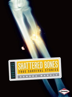 cover image of Shattered Bones
